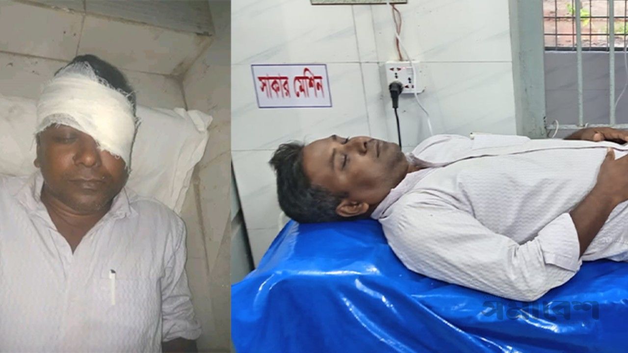 বিদ্যালয়ের পানির ড্রাম চুরির প্রতিবাদ করায় দুই শিক্ষককে লোহার রড দিয়ে মারধর